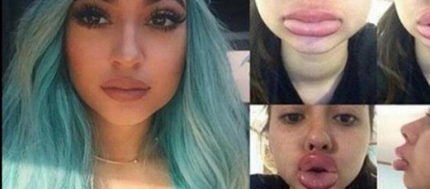 Kylie Jenner e alguns dos resultados do desafio Kylie Jenner e alguns dos resultados do desafio