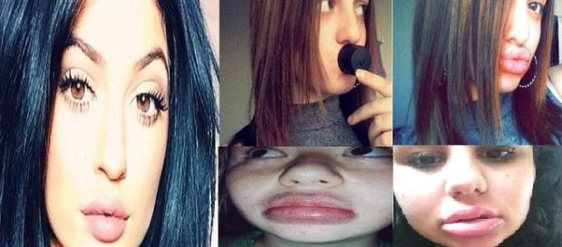 Kylie Jenner y sus seguidoras Kylie Jenner y sus seguidoras