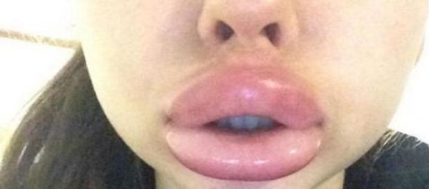 Le Kylie Jenner Challenge, nouveau défi des ados. Le Kylie Jenner Challenge, nouveau défi des ados.