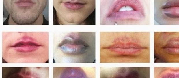 Danos obtidos com o uso do CandyLipz. Danos obtidos com o uso do CandyLipz.