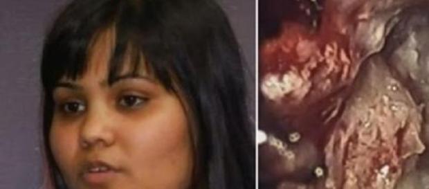 Karanam teve o tumor durante 26 anos Karanam teve o tumor durante 26 anos