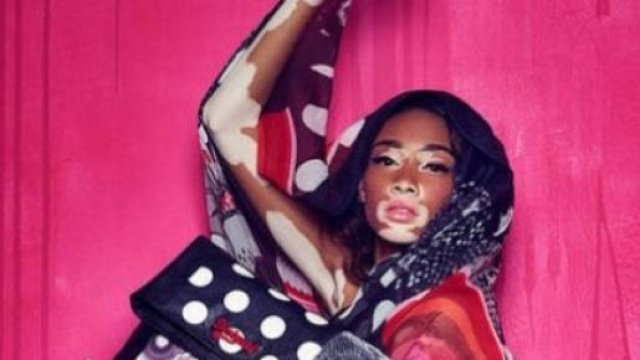 Chantelle Winnie Harlow per Desigual 