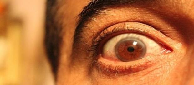 Los ojos ciegos bien abiertos Los ojos ciegos bien abiertos