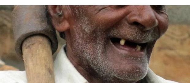 Militares brasileiros sem número mínimo de dentes Militares brasileiros sem número mínimo de dentes