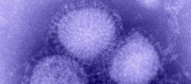 Imagen del virus H1N1 causante de la gripe Imagen del virus H1N1 causante de la gripe