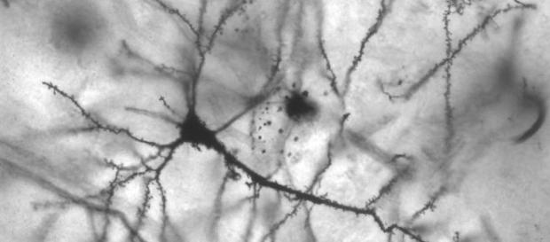Detalle de una red neuronal Detalle de una red neuronal