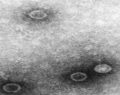 La poliomielitis, una enfermedad con historia