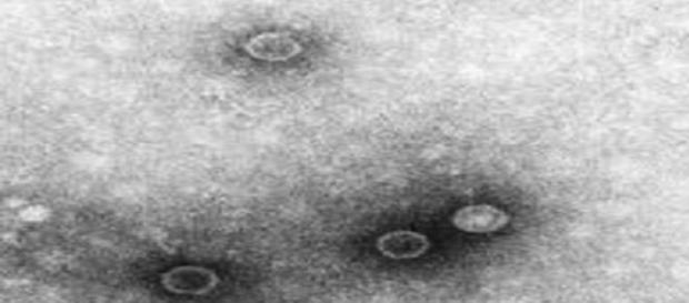 Así se ve el Polio Virus. Así se ve el Polio Virus.