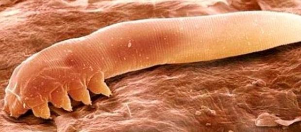 Vivimos con cientos de ácaros en nuestra cara Vivimos con cientos de ácaros en nuestra cara