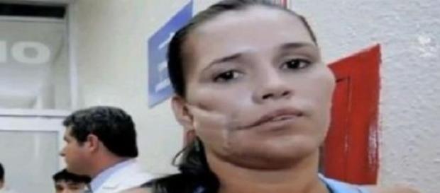 Femeia care a șocat medicii Femeia care a șocat medicii