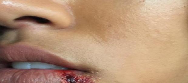 Karrueche Trans blutige Lippe vom 26. Mai Karrueche Trans blutige Lippe vom 26. Mai