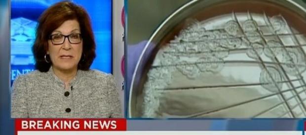 Wysłano żywego wąglika, CNN Wysłano żywego wąglika, CNN