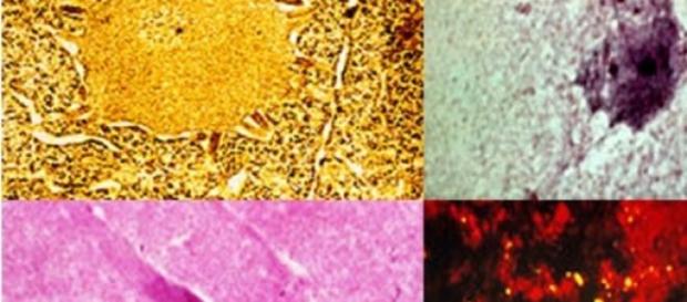 Microscopia para visualizar Corpúsculos de Negri Microscopia para visualizar Corpúsculos de Negri