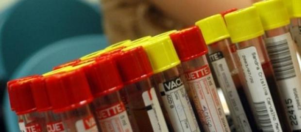 Análises ao sangue podem detectar cancro Análises ao sangue podem detectar cancro