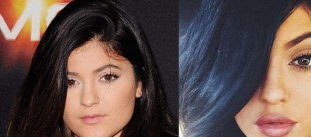 O antes e o depois de Kylie Jenner O antes e o depois de Kylie Jenner