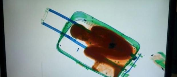 L'incredibile immagine apparsa allo scanner L'incredibile immagine apparsa allo scanner