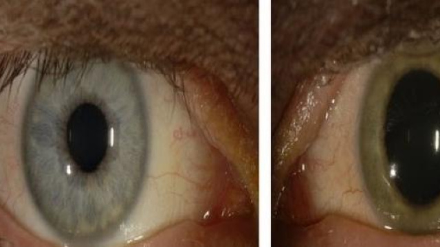 L'occhio ed il cambio di colore