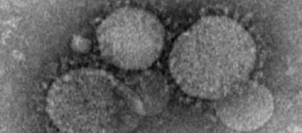 Imagen microscópica del coronavirus del MERS Imagen microscópica del coronavirus del MERS