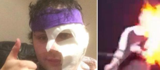 Michael Clifford dos 5SOS queimou-se em palco Michael Clifford dos 5SOS queimou-se em palco