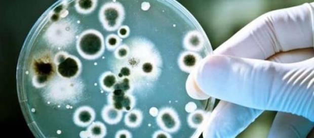 vencer infecctiones por candida en 4 pasos vencer infecctiones por candida en 4 pasos
