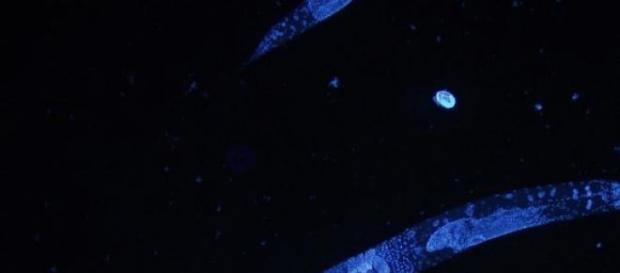 Nano-sensor descoberto em neurónio das C. elegans Nano-sensor descoberto em neurónio das C. elegans