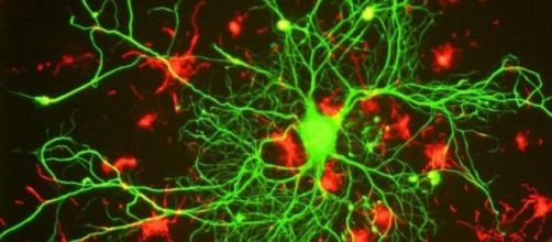 Neurone attaccato da cellule immunitarie 