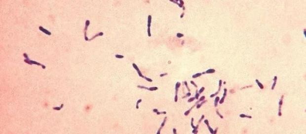 Corynebacterium diphtheriae Corynebacterium diphtheriae