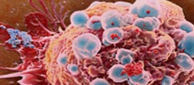 Es un avance para la lucha contra el cáncer Es un avance para la lucha contra el cáncer