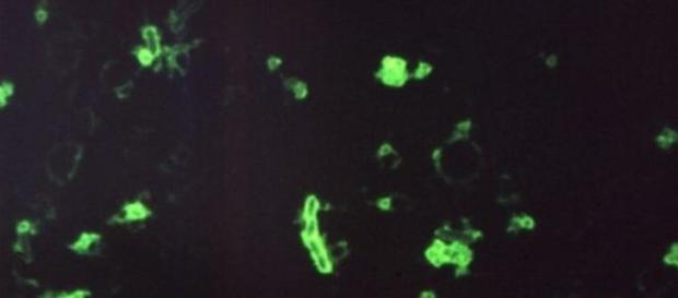 Imaginea microscopică a bacteriei ce induce ciuma Imaginea microscopică a bacteriei ce induce ciuma