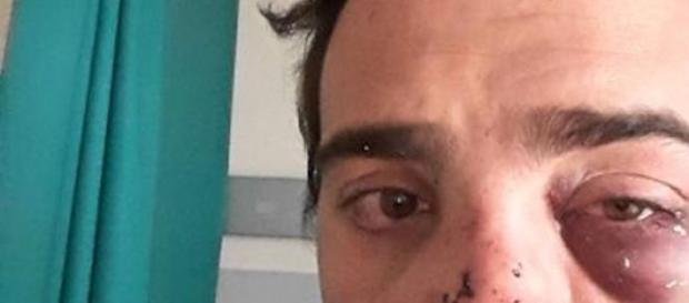 Alexandre, utilisateur Uber agressé Alexandre, utilisateur Uber agressé