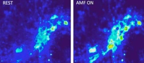 neurone a riposo (sx) e attivato dal calore (dx)