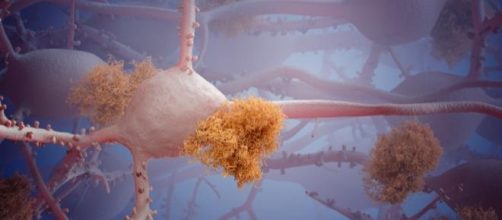 Ricostruzione 3D di neurone e placche amiloidi