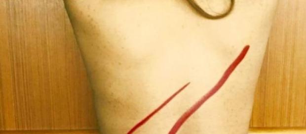 La campagne #Backlash au secours de Raif Badawi. La campagne #Backlash au secours de Raif Badawi.
