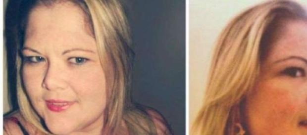 Mulher morreu após perder 45 kg em seis meses. Mulher morreu após perder 45 kg em seis meses.