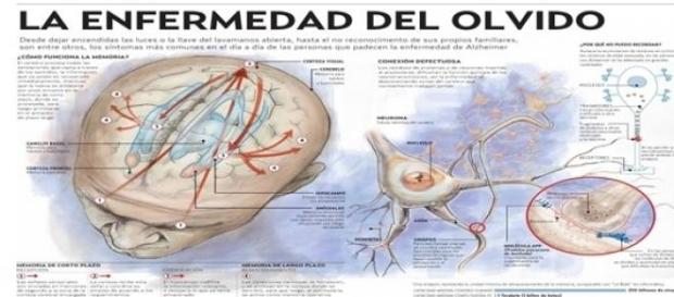 La ciencia sigue su lucha contra el olvido La ciencia sigue su lucha contra el olvido