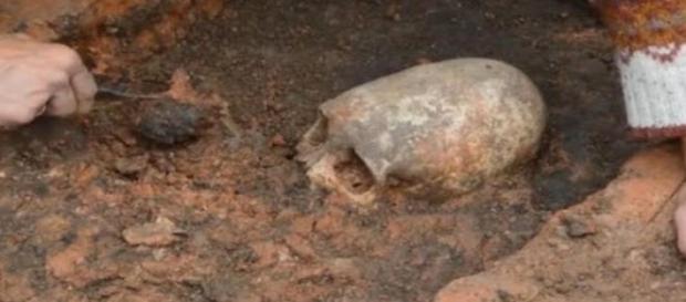 Teschio allungato scoperto in Russia Teschio allungato scoperto in Russia