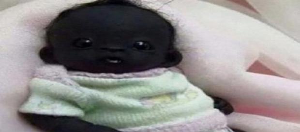 cel mai negru bebeluș de pe Pământ cel mai negru bebeluș de pe Pământ