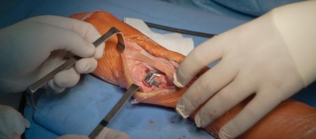 Cirurgia inovadora traz benefícios para os doentes Cirurgia inovadora traz benefícios para os doentes