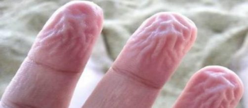 Pelle delle dita raggrinzita