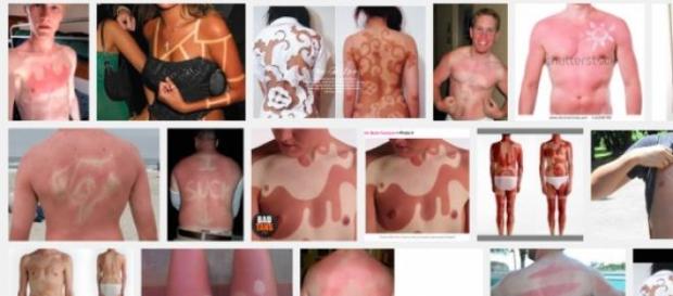It's easy to find 'sunburnt art' online. It's easy to find 'sunburnt art' online.