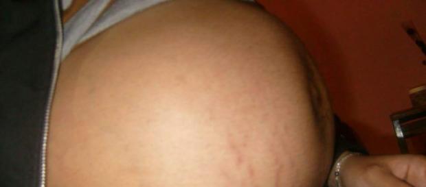 Embarazo de 36 semanas de gestación. Embarazo de 36 semanas de gestación.