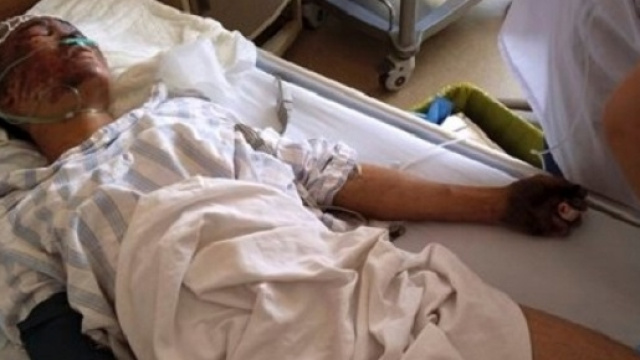 Vigile del fuoco vivo ma in gravissime condizioni