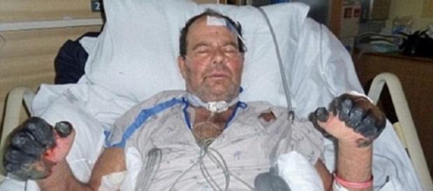 Uomo muore di peste bubbonica negli Usa Uomo muore di peste bubbonica negli Usa