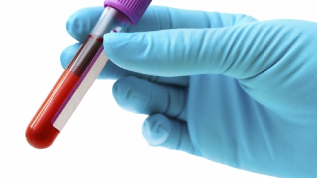 setaccio per scoprire tumori nel sangue