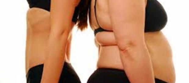 Antes de depois de um tratamento de obesidade. Antes de depois de um tratamento de obesidade.