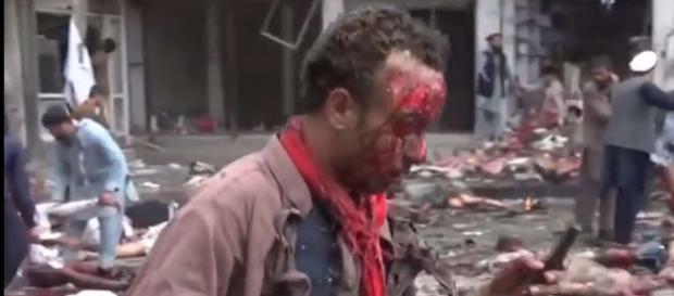 Supravieţuitor al unui atac cu bombă în Afganistan Supravieţuitor al unui atac cu bombă în Afganistan