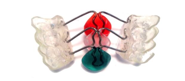 Adelgazar con DentaSlim-Up, aparato bucal Adelgazar con DentaSlim-Up, aparato bucal