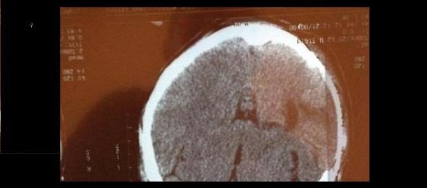 La radiografia col volto di Gesù La radiografia col volto di Gesù
