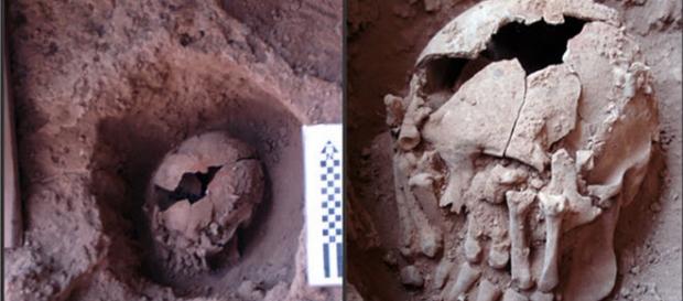 Cranio decapitato con mani che coprono gli occhi Cranio decapitato con mani che coprono gli occhi