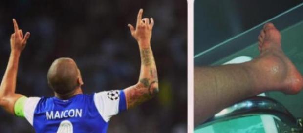 Maicon lesionou-se e permaneceu em campo. Maicon lesionou-se e permaneceu em campo.